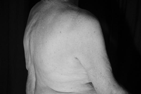 A black and white photograph showing seated person's back from neck to waist. The shoulder and spine stand firm in side loose and wrinkled flesh.